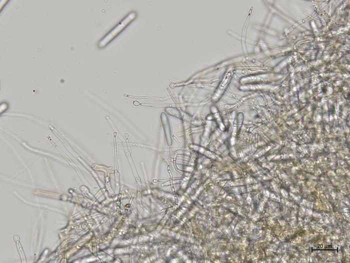 Dactylonectria_torresensis_3