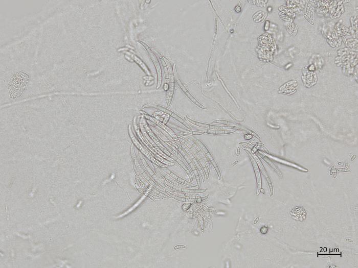 Fusarium_oxysporum_5