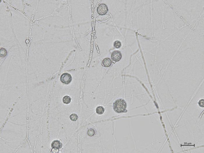 Globisporangium_irregulare_3