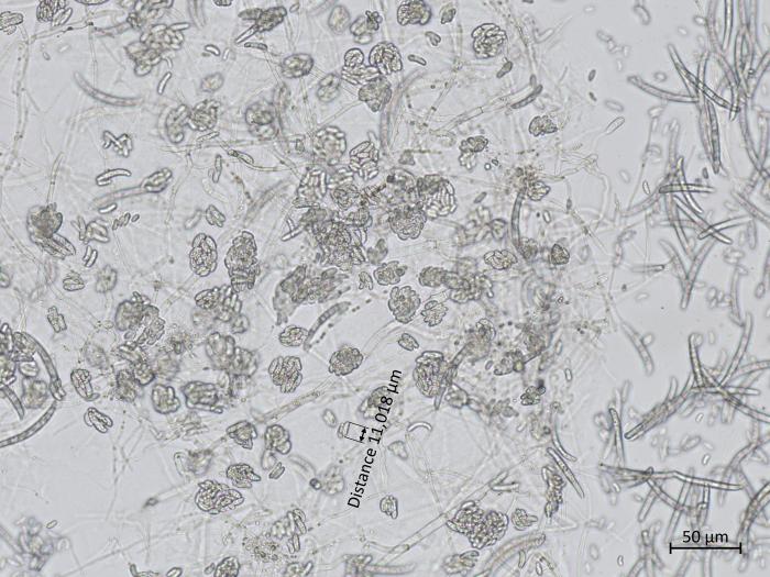 Neocosmospora_solani_3