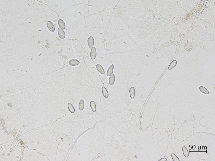 Orbilia_blumenaviensis_2