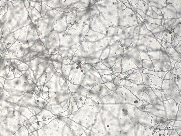 Phytophthora_cactorum_1