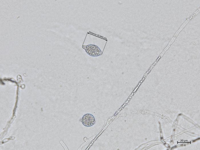 Phytophthora_cactorum_5
