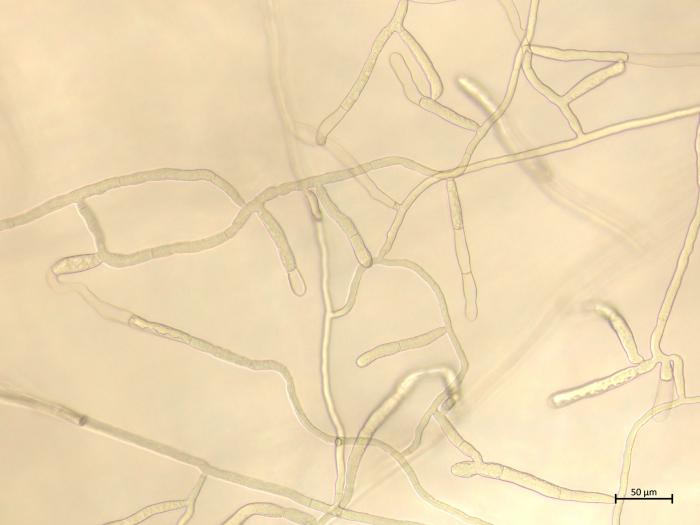 Rhizoctonia_solani_7
