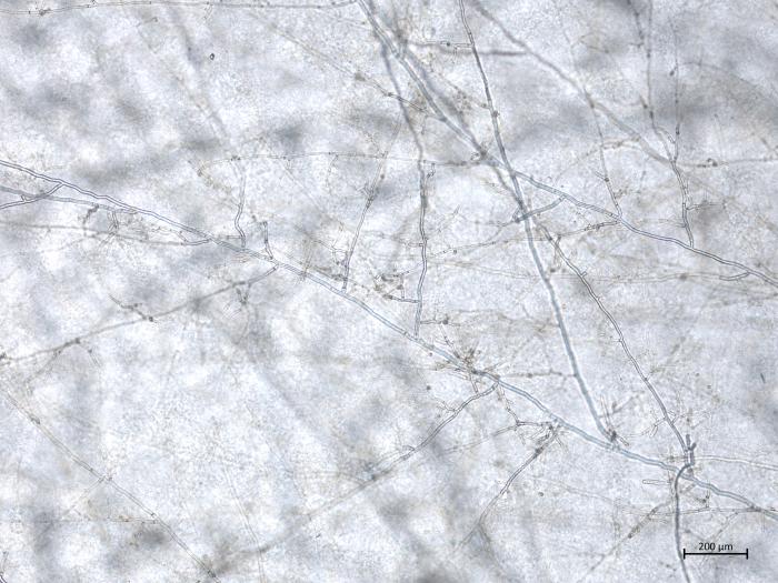 Rhizoctonia_solani_3