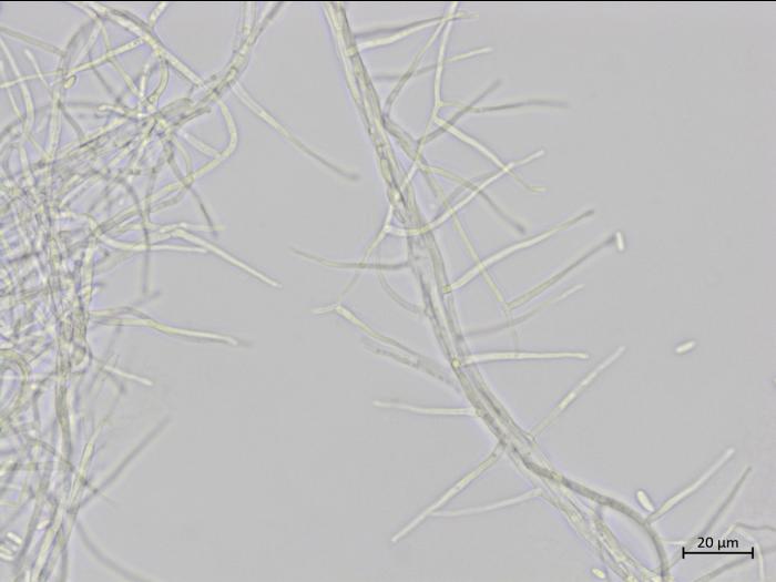 Sarocladium_strictum_4