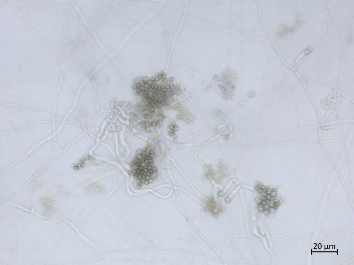 Sclerotinia_sclerotiorum_5