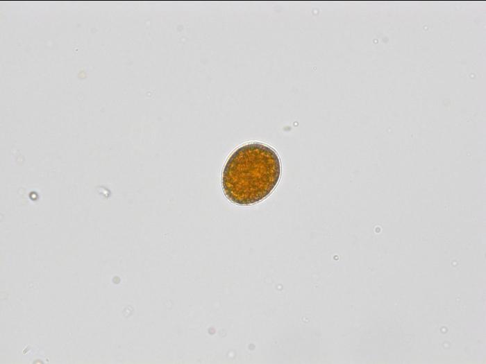 Arthuriomyces sp.