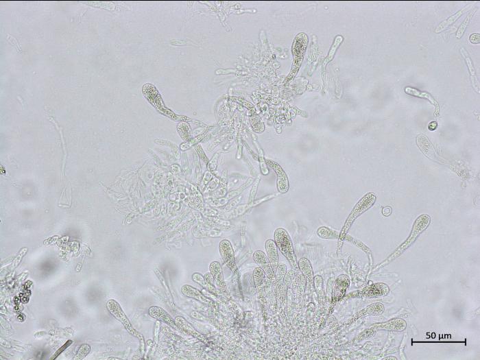 Chaetomium_sp_4
