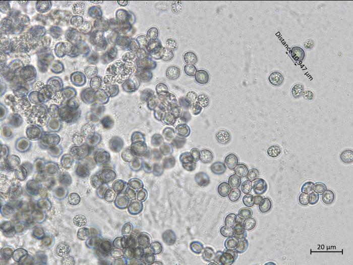 Chaetomium_sp_5