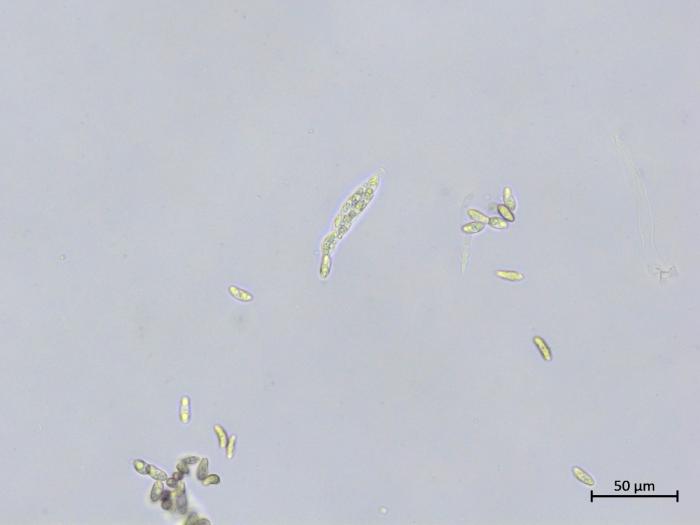 Colletotrichum_boninense_2