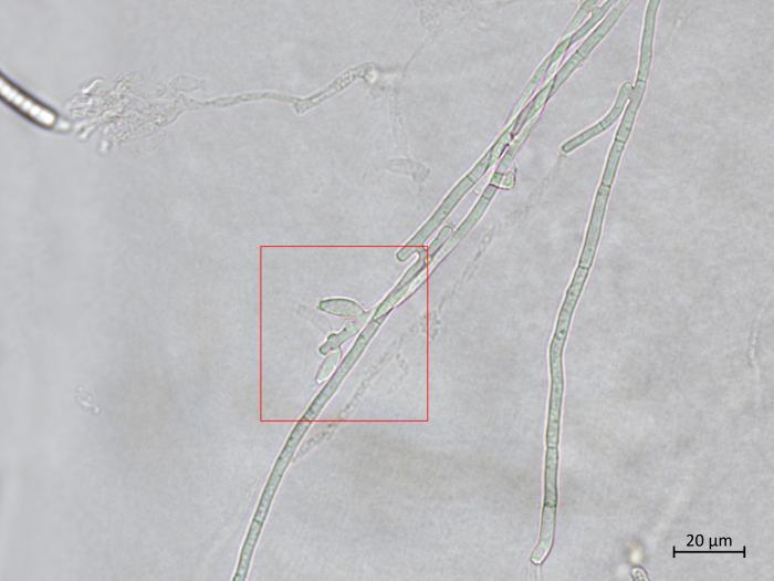 Fusarium_sambucinum_7