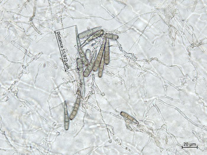 Helminthosporium_solani_7