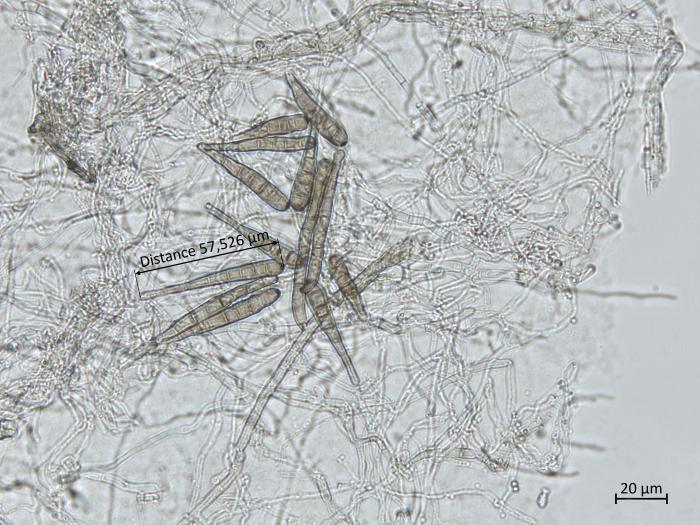 Helminthosporium_solani_8