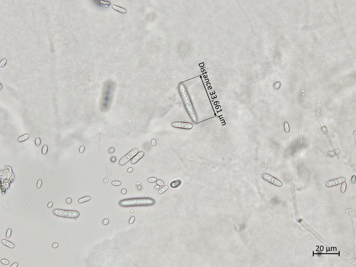 Ilyonectria_liriodendri_4