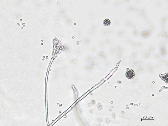 Penicillium_olsonii_7