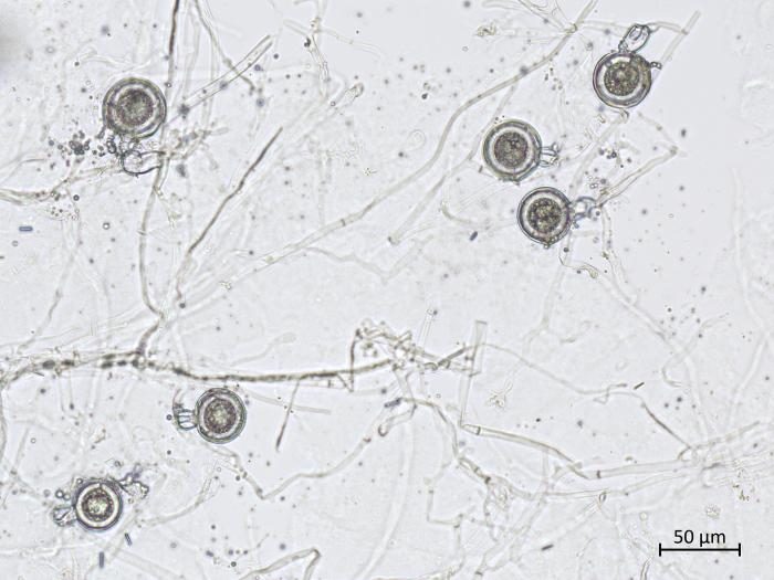 Phytophthora_erythroseptica_6