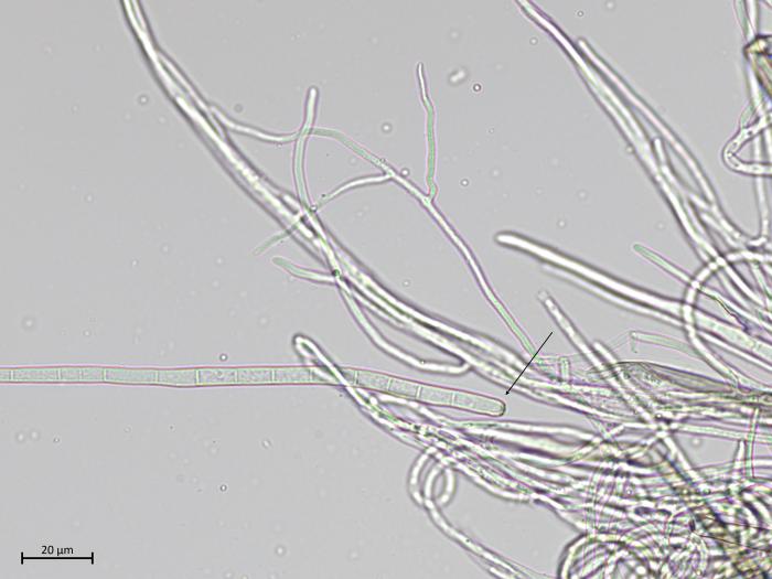 Cercospora_sp_2