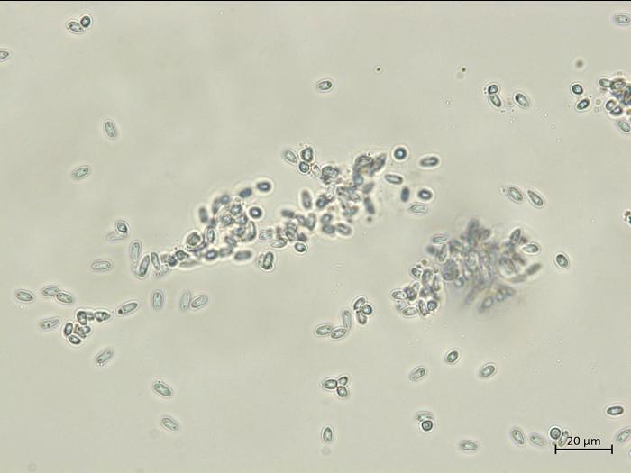Diaporthe_sp_5