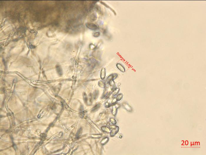 Neofusicoccum_parvum_7