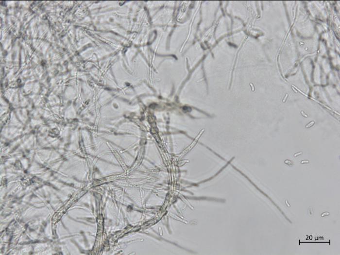 Phaeoacremonium_fraxinopennsylvanicum_1