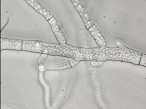 Sclerotinia_sp._1