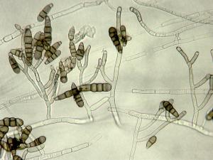 Alternaria_brassicicola_1