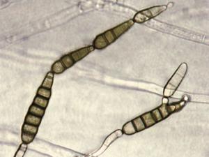 Alternaria_brassicicola_2