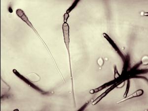 Alternaria_cichorii_1