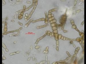 Alternaria_cucumerina_D52977-3_LQ.jpg