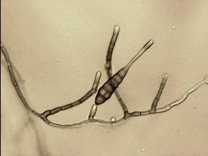 Alternaria_tagetica_1