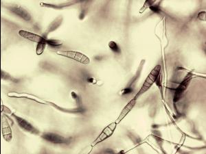 Alternaria_tenuissima-11_LQ