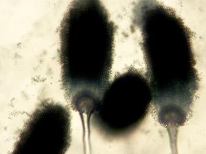 Aspergillus-06_LQ