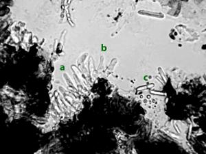 Coleophoma_empetri-05a_LQ