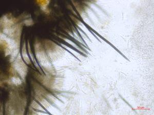 Colletotrichum_sp_4