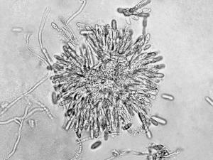 Colletotrichum_gloeosporioides_1
