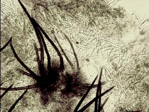 Colletotrichum_truncatum_1