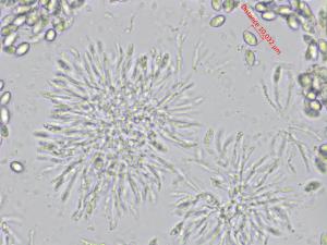 Coniella_diplodiella_4