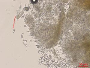 Cryptosporiopsis_tarraconensis_1