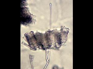 Cylindrocladium_sp_2