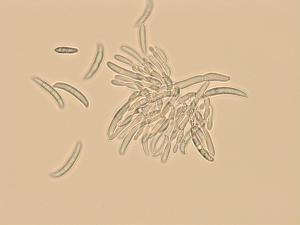 Fusarium_sp_3