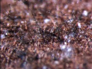 Helminthosporium_sp_3