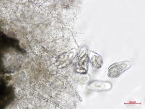 Leptosphaerulina_sp_2