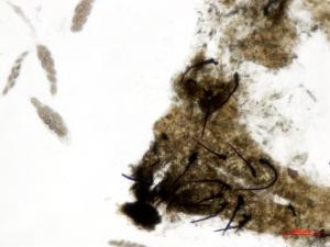 Physalospora_vaccinii_1