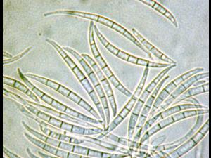 Fusarium_acuminatum_2