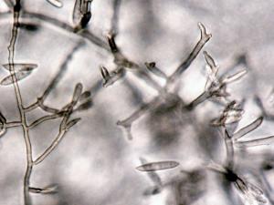 Fusarium_camptoceras_2