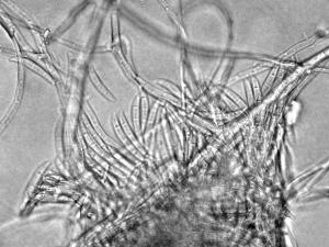 Fusarium_heterosporum_1