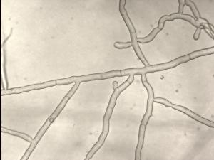 Rhizoctonia_sp_1