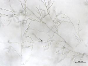 Rhizoctonia_sp_5