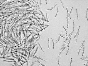 Septoria_sp_2